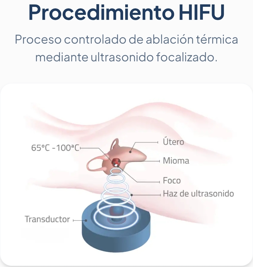 #HIFU: Innovadora tecnología China para tratamiento del cáncer